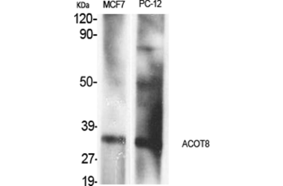 Western Blot - Anti-ACOT8 Antibody (C14273) - Antibodies.com
