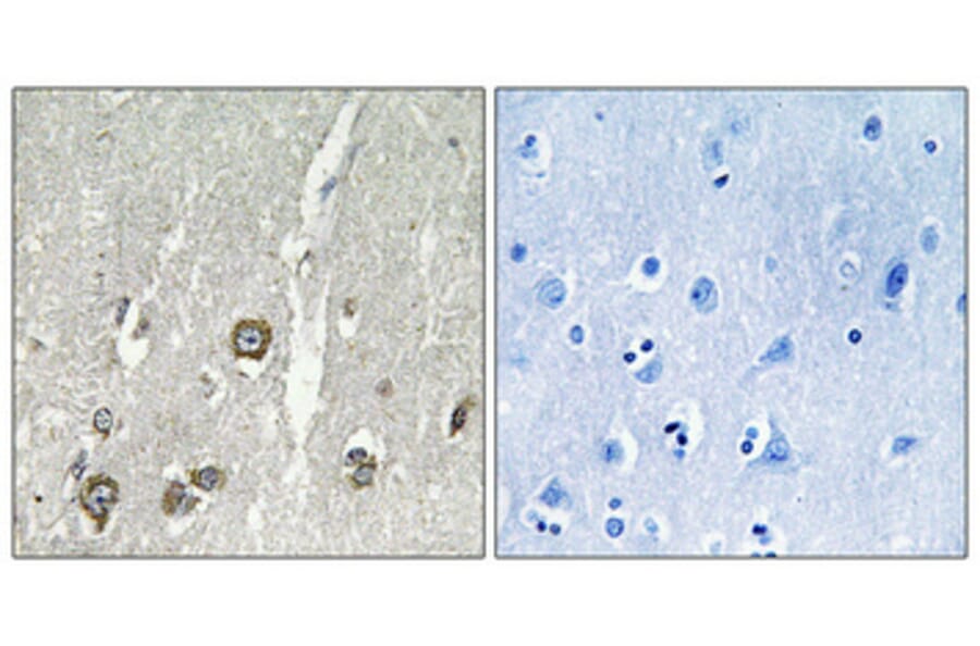 Immunohistochemistry - Anti-ACOT8 Antibody (C14273) - Antibodies.com