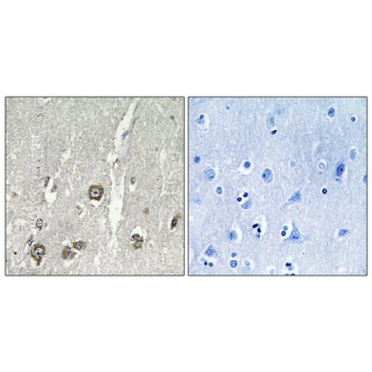 Immunohistochemistry - Anti-ACOT8 Antibody (C14273) - Antibodies.com