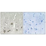 Immunohistochemistry - Anti-ACOT8 Antibody (C14273) - Antibodies.com