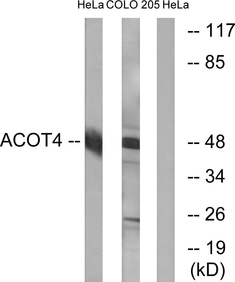 Western blot analysis of lysates from HeLa and COLO cells using Anti-ACOT4 Antibody. The right hand lane represents a negative control, where the antibody is blocked by the immunising peptide.