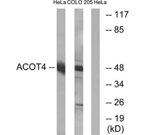 Western Blot - Anti-ACOT4 Antibody (C14272) - Antibodies.com