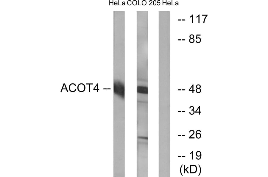 Western Blot - Anti-ACOT4 Antibody (C14272) - Antibodies.com