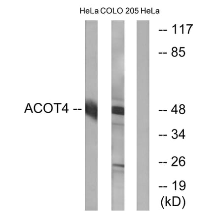 Western Blot - Anti-ACOT4 Antibody (C14272) - Antibodies.com