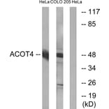 Western Blot - Anti-ACOT4 Antibody (C14272) - Antibodies.com