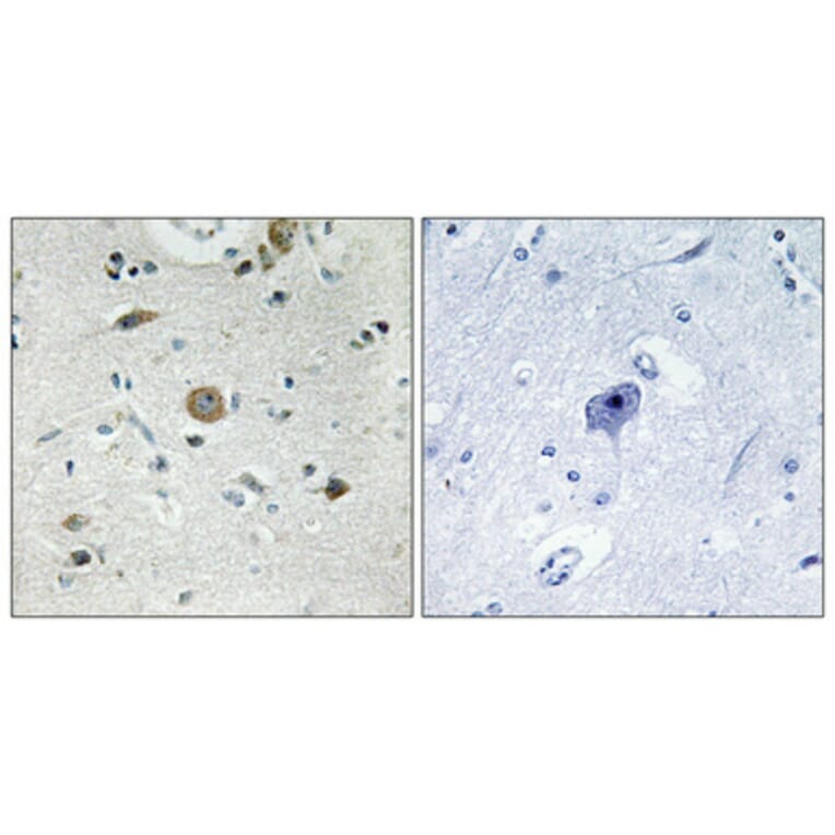 Immunohistochemistry - Anti-ACOT4 Antibody (C14272) - Antibodies.com