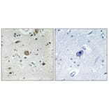 Immunohistochemistry - Anti-ACOT4 Antibody (C14272) - Antibodies.com