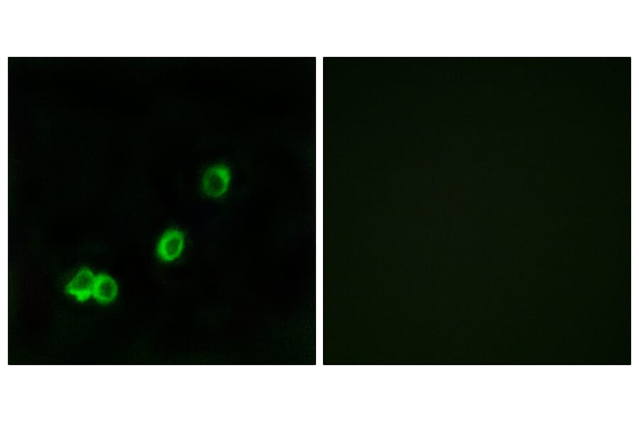 Immunofluorescence - Anti-ACOT1 Antibody (C14268) - Antibodies.com