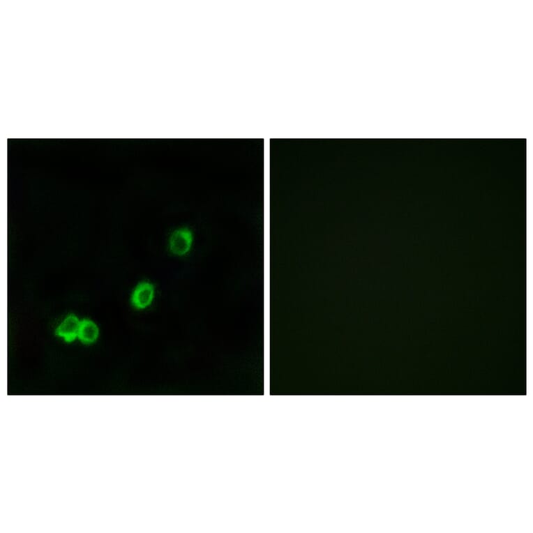 Immunofluorescence - Anti-ACOT1 Antibody (C14268) - Antibodies.com