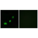 Immunofluorescence - Anti-ACOT1 Antibody (C14268) - Antibodies.com