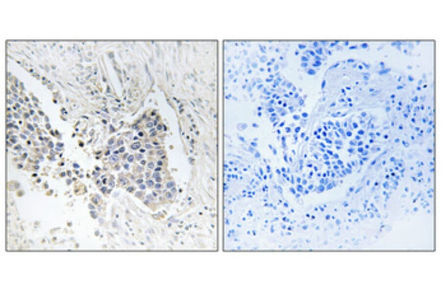 Immunohistochemistry - Anti-ACOT1 Antibody (C14268) - Antibodies.com