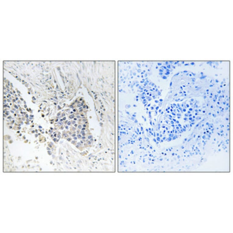 Immunohistochemistry - Anti-ACOT1 Antibody (C14268) - Antibodies.com