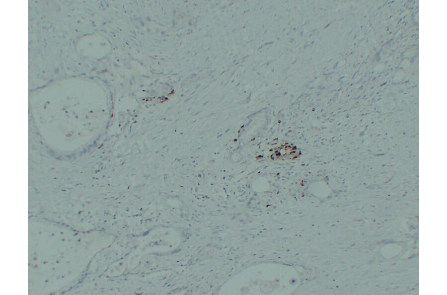 Immunohistochemistry - Anti-IGF 2 Antibody (V0085) - Antibodies.com