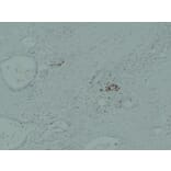 Immunohistochemistry - Anti-IGF 2 Antibody (V0085) - Antibodies.com