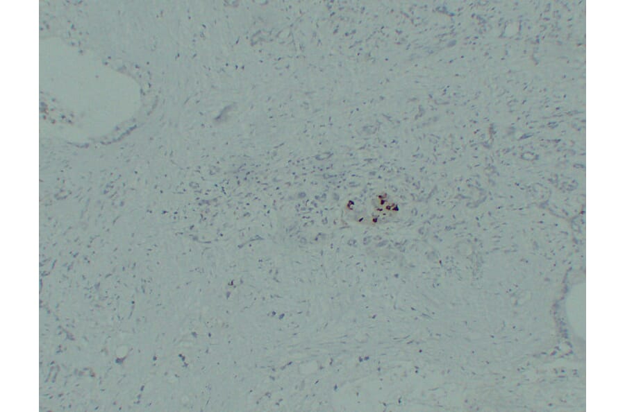 Immunohistochemistry - Anti-IGF 2 Antibody (V0085) - Antibodies.com