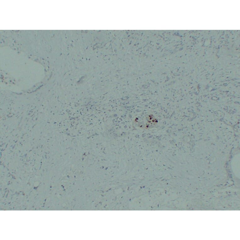 Immunohistochemistry - Anti-IGF 2 Antibody (V0085) - Antibodies.com