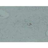 Immunohistochemistry - Anti-IGF 2 Antibody (V0085) - Antibodies.com