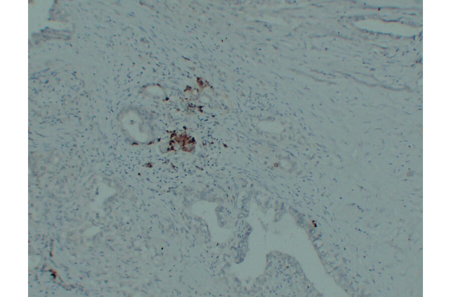 Immunohistochemistry - Anti-IGF 2 Antibody (V0085) - Antibodies.com