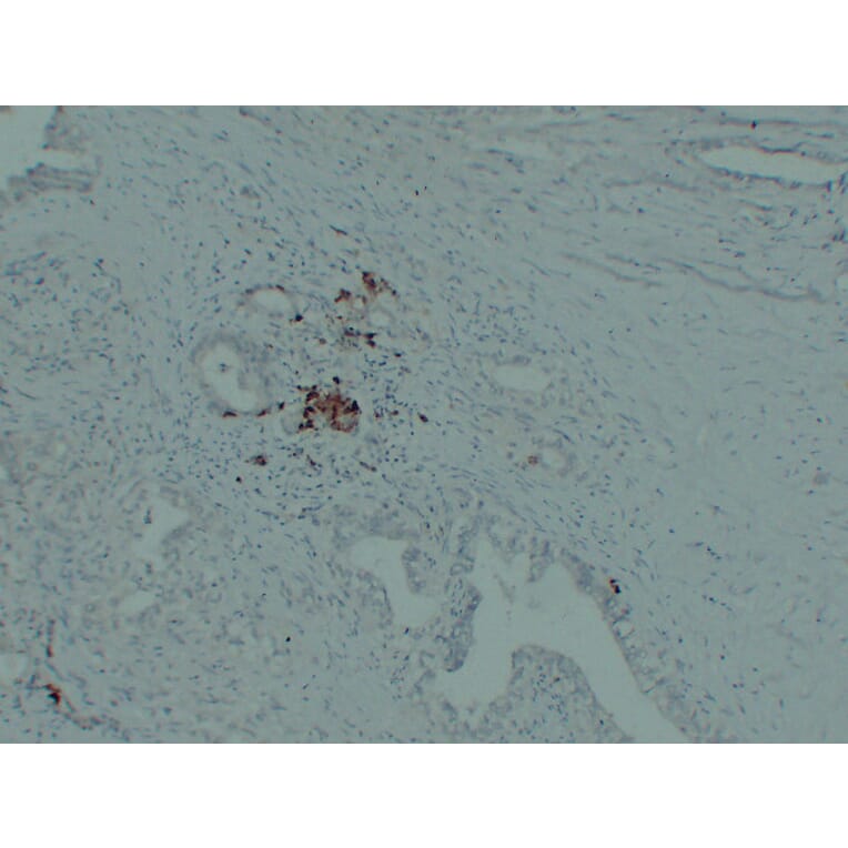 Immunohistochemistry - Anti-IGF 2 Antibody (V0085) - Antibodies.com