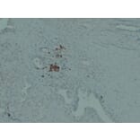 Immunohistochemistry - Anti-IGF 2 Antibody (V0085) - Antibodies.com
