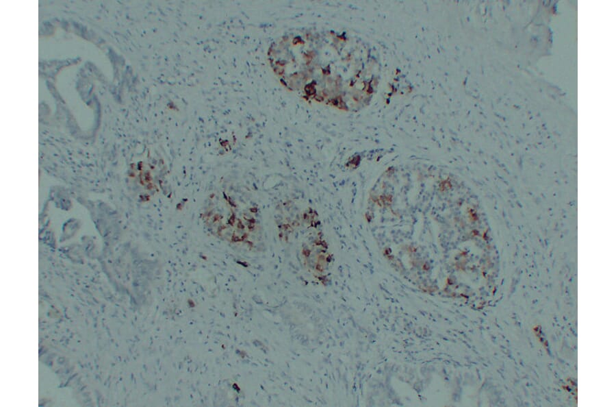 Immunohistochemistry - Anti-IGF 2 Antibody (V0085) - Antibodies.com