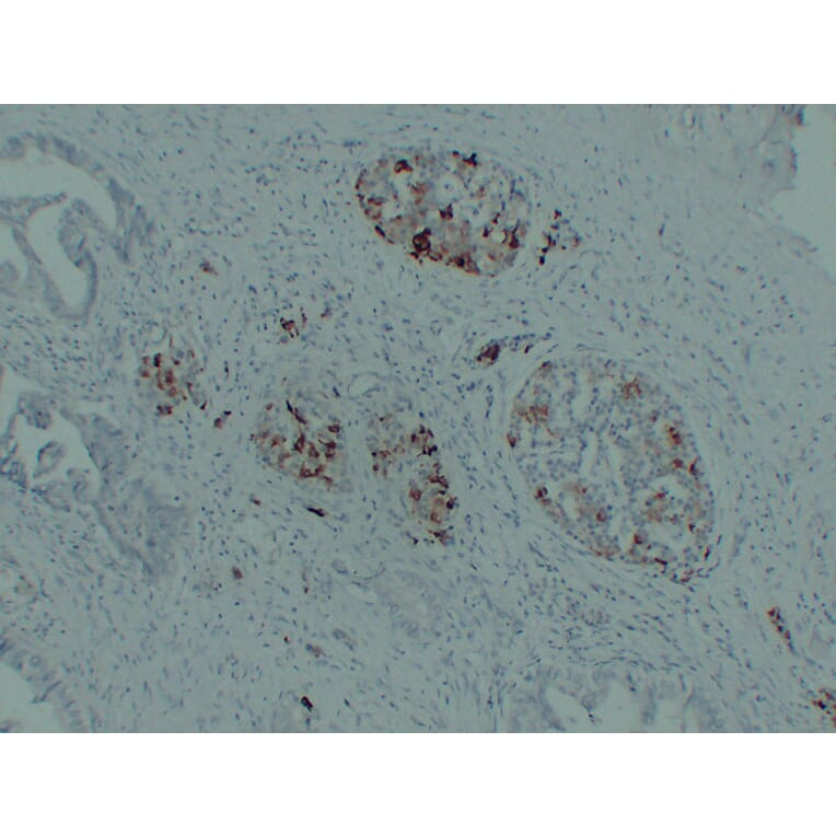 Immunohistochemistry - Anti-IGF 2 Antibody (V0085) - Antibodies.com