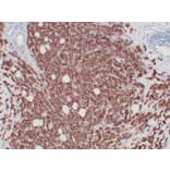 Immunohistochemistry - Anti-Her 2 Antibody (V0083) - Antibodies.com