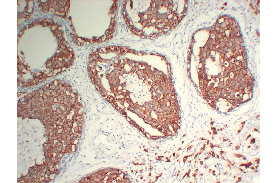 Immunohistochemistry - Anti-Her 2 Antibody (V0083) - Antibodies.com