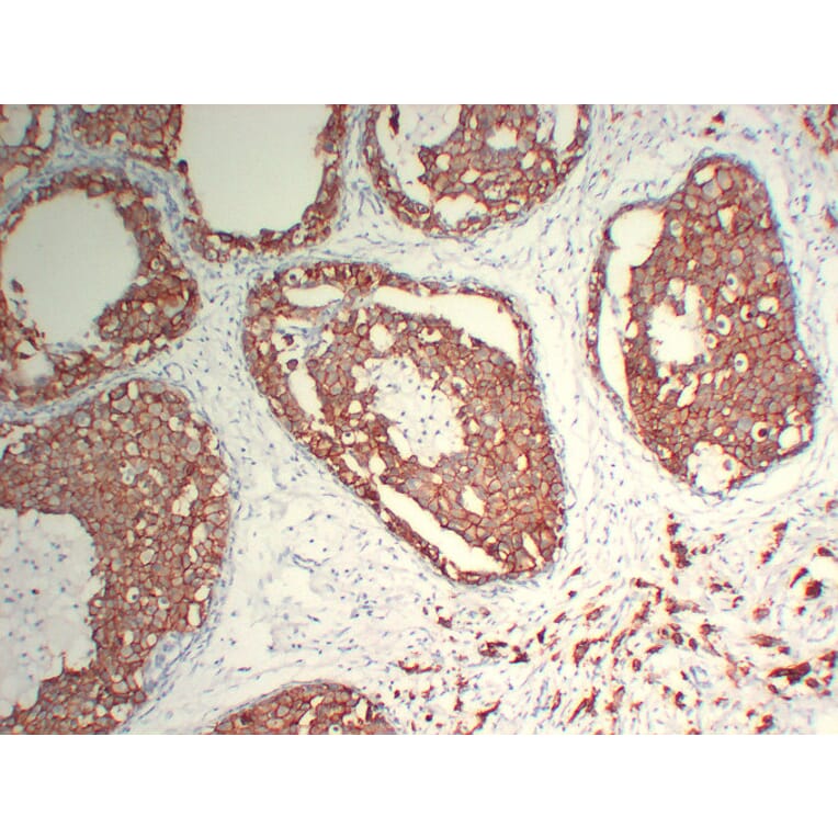Immunohistochemistry - Anti-Her 2 Antibody (V0083) - Antibodies.com