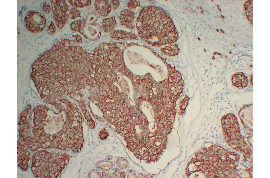 Immunohistochemistry - Anti-Her 2 Antibody (V0083) - Antibodies.com