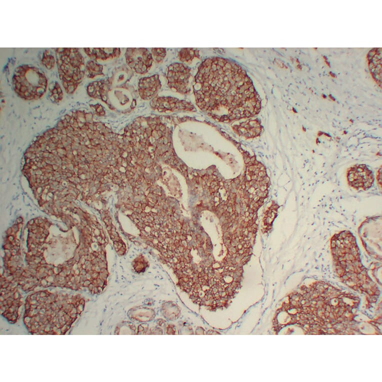 Immunohistochemistry - Anti-Her 2 Antibody (V0083) - Antibodies.com