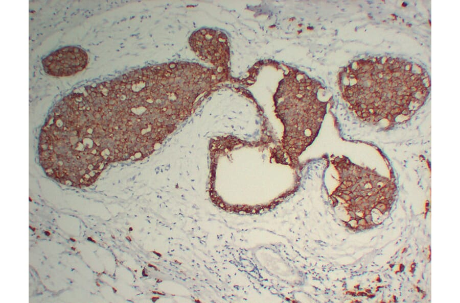 Immunohistochemistry - Anti-Her 2 Antibody (V0083) - Antibodies.com
