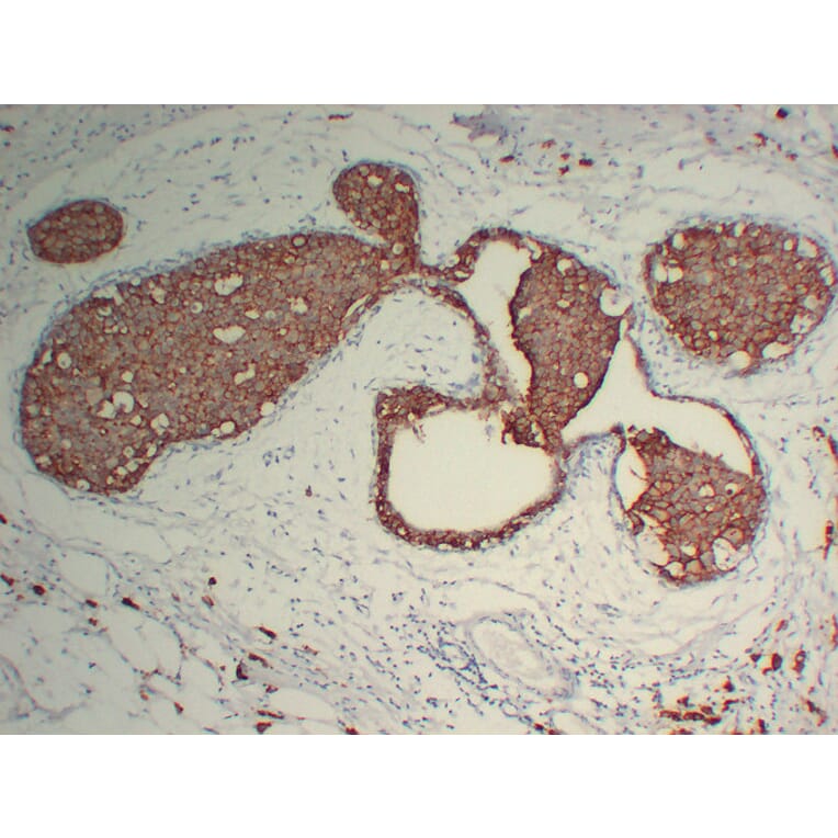 Immunohistochemistry - Anti-Her 2 Antibody (V0083) - Antibodies.com