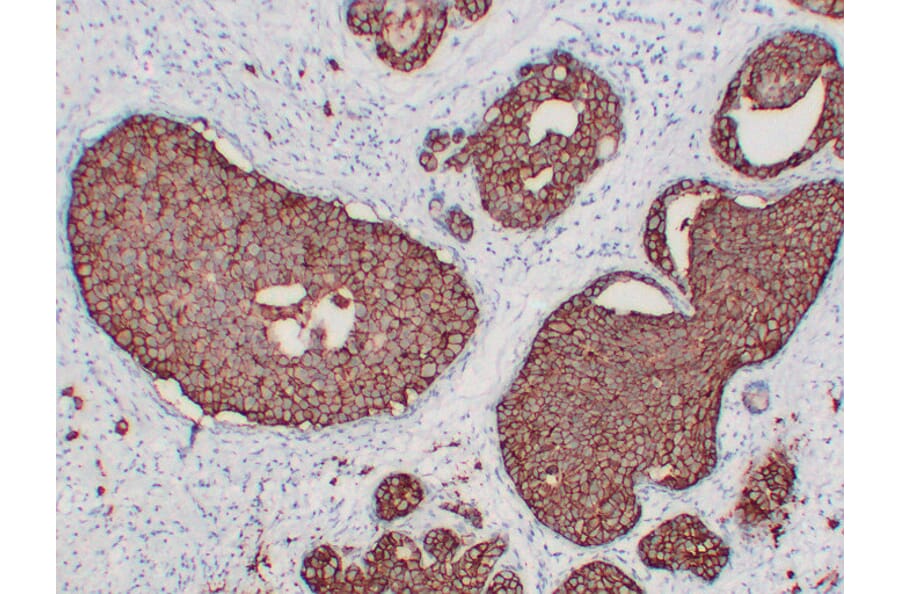 Immunohistochemistry - Anti-Her 2 Antibody (V0083) - Antibodies.com