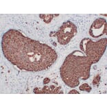 Immunohistochemistry - Anti-Her 2 Antibody (V0083) - Antibodies.com
