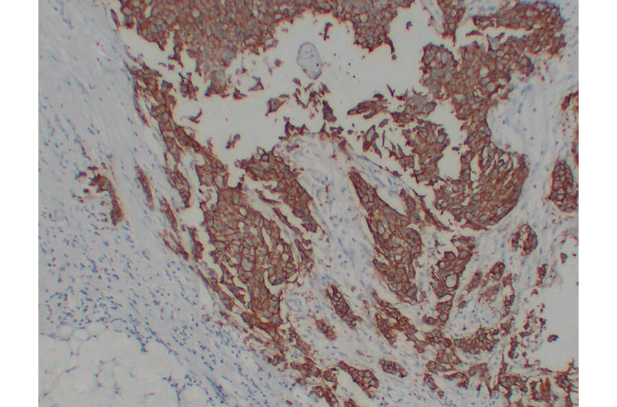 Immunohistochemistry - Anti-Her 2 Antibody (V0083) - Antibodies.com
