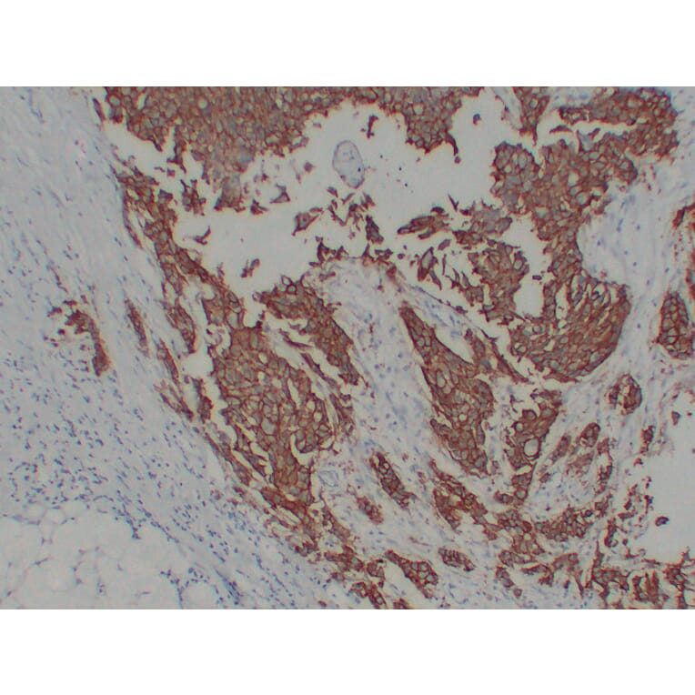 Immunohistochemistry - Anti-Her 2 Antibody (V0083) - Antibodies.com