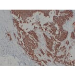 Immunohistochemistry - Anti-Her 2 Antibody (V0083) - Antibodies.com