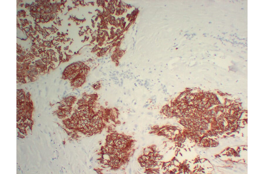 Immunohistochemistry - Anti-Her 2 Antibody (V0083) - Antibodies.com