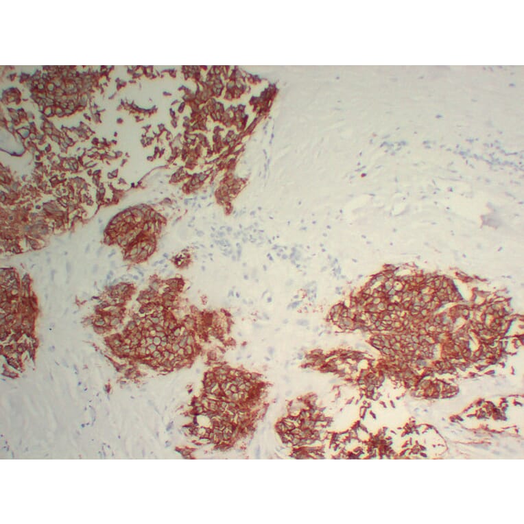 Immunohistochemistry - Anti-Her 2 Antibody (V0083) - Antibodies.com
