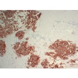 Immunohistochemistry - Anti-Her 2 Antibody (V0083) - Antibodies.com