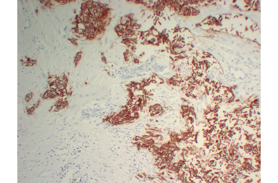 Immunohistochemistry - Anti-Her 2 Antibody (V0083) - Antibodies.com