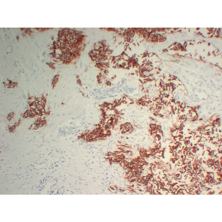 Immunohistochemistry - Anti-Her 2 Antibody (V0083) - Antibodies.com
