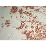 Immunohistochemistry - Anti-Her 2 Antibody (V0083) - Antibodies.com