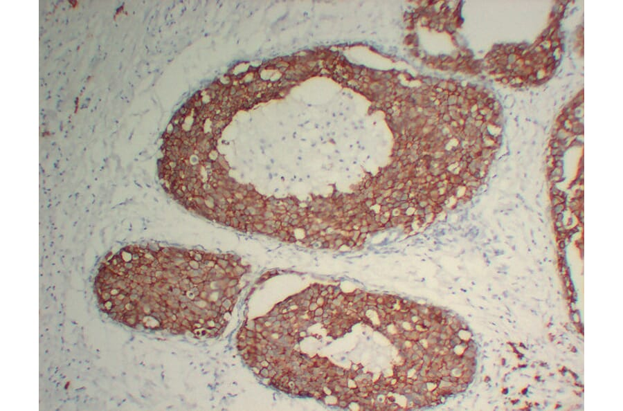 Immunohistochemistry - Anti-Her 2 Antibody (V0083) - Antibodies.com