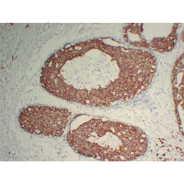 Immunohistochemistry - Anti-Her 2 Antibody (V0083) - Antibodies.com