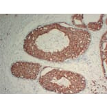 Immunohistochemistry - Anti-Her 2 Antibody (V0083) - Antibodies.com
