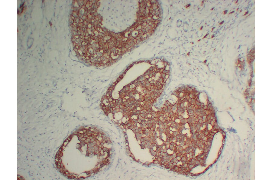 Immunohistochemistry - Anti-Her 2 Antibody (V0083) - Antibodies.com