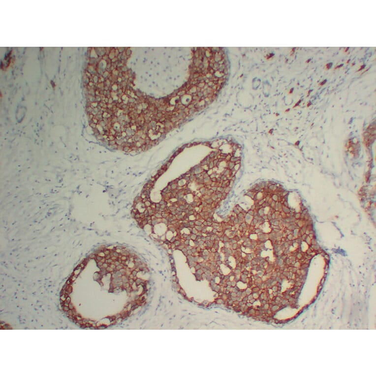 Immunohistochemistry - Anti-Her 2 Antibody (V0083) - Antibodies.com