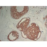 Immunohistochemistry - Anti-Her 2 Antibody (V0083) - Antibodies.com